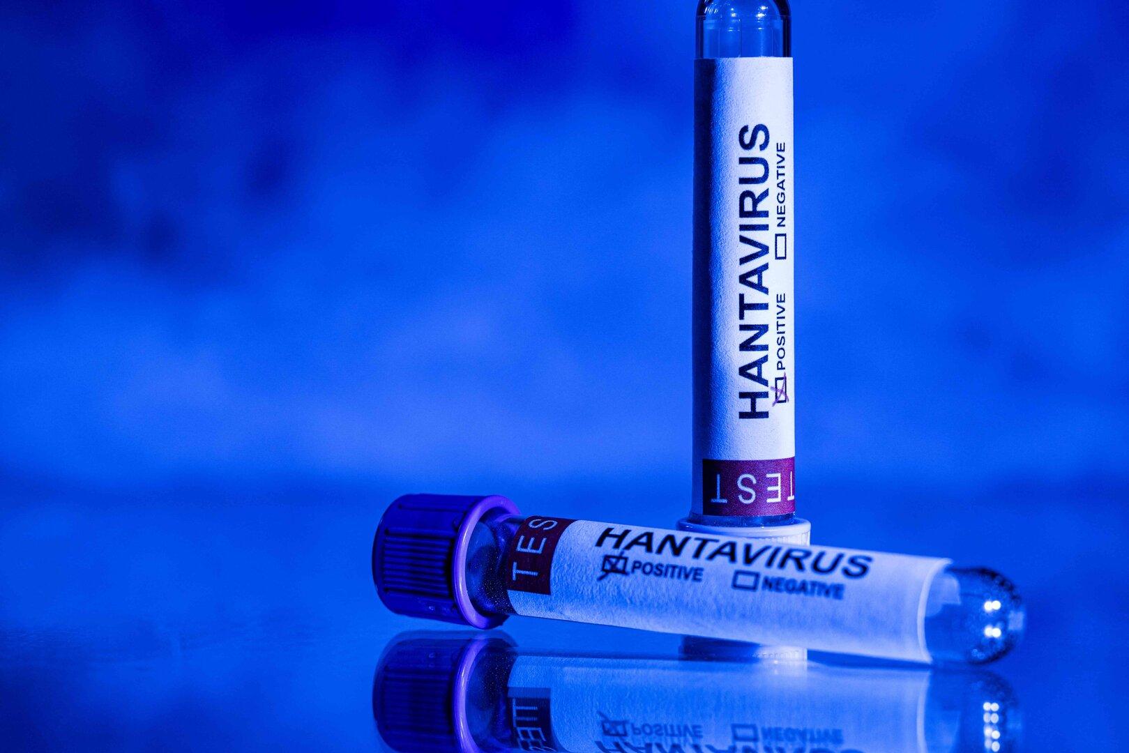 Hantavirus: Österreicher war mit infizierter Person im Flugzeug
