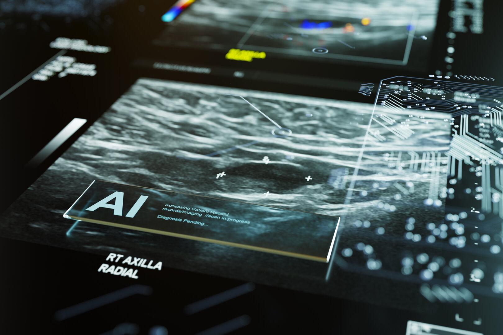 Ein Ultraschallbild mit digitalen Markierungen und dem Hinweis auf eine KI-gestützte Analyse wird angezeigt.